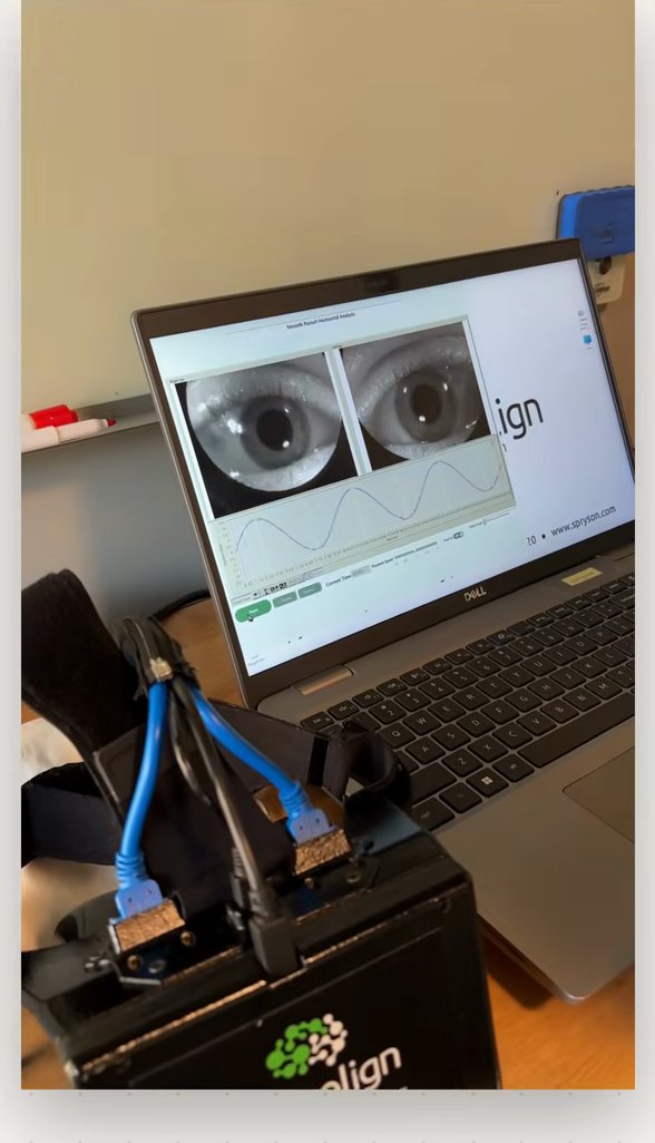 Video-oculography testing at The Keiser Clinic